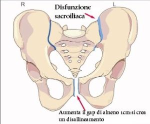 sinfisi pubica gravidanza