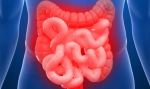 colon irritabile