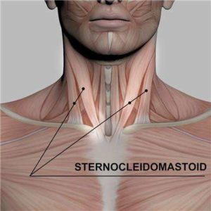 muscolo sternocleidomastoideo