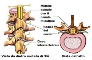 anatomia del disco intervertebrale