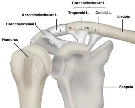 Patologie Acromion Claveare