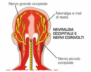 dolore alla nuca