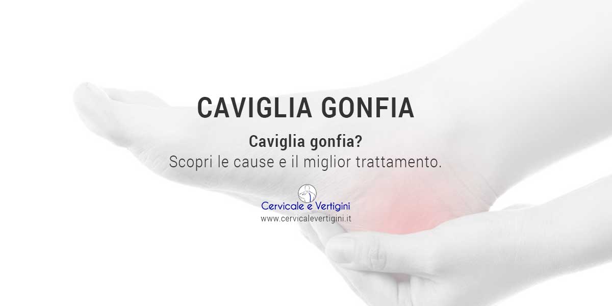 caviglie gonfie