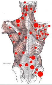 trigger point mappa