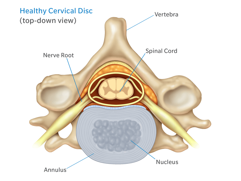 disco cervicale