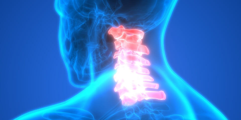 ernia cervicale sintomi neurologici