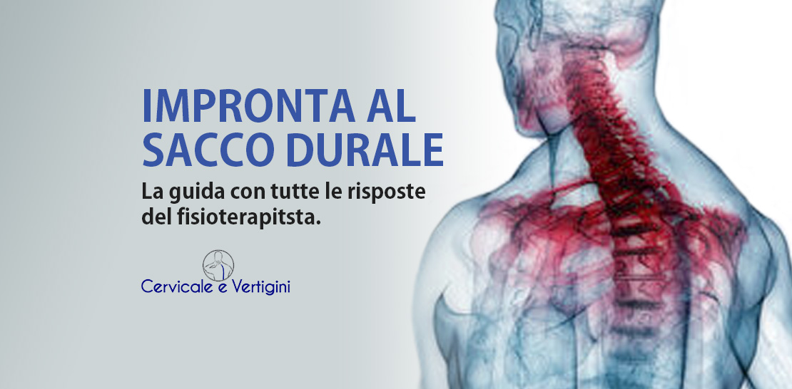 Sacco Durale: la guida con tutte le risposte