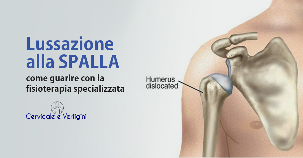 Lussazione Spalla: Sintomi, Cure e Recupero