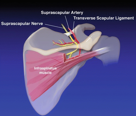 nervo sovrascapolare