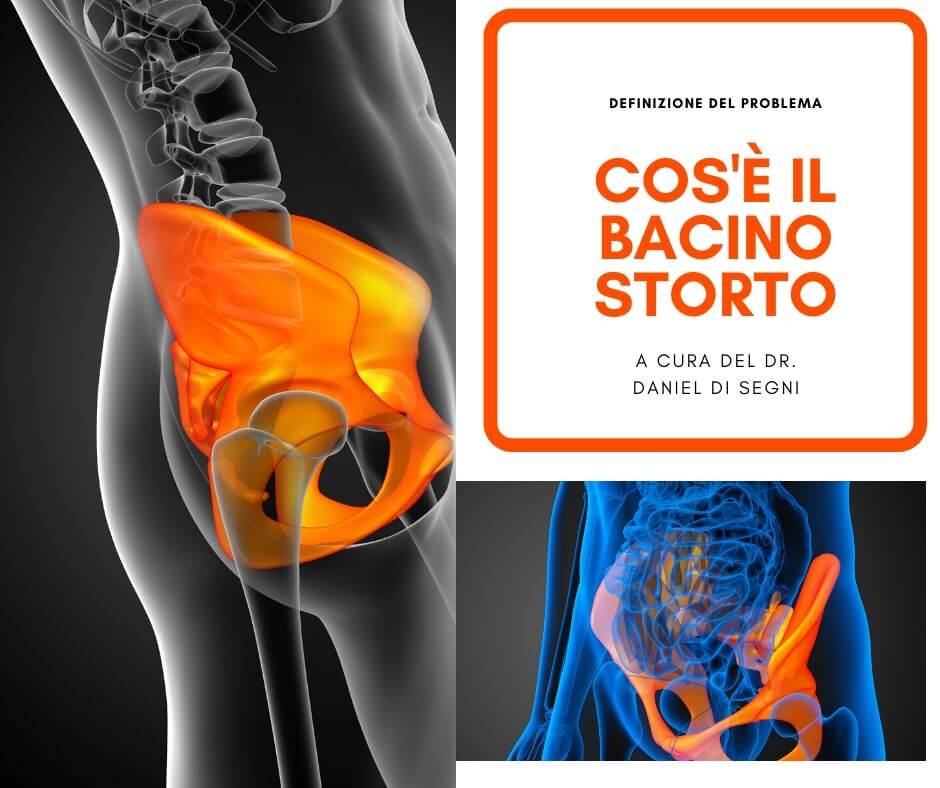 fisioterapia bacino storto