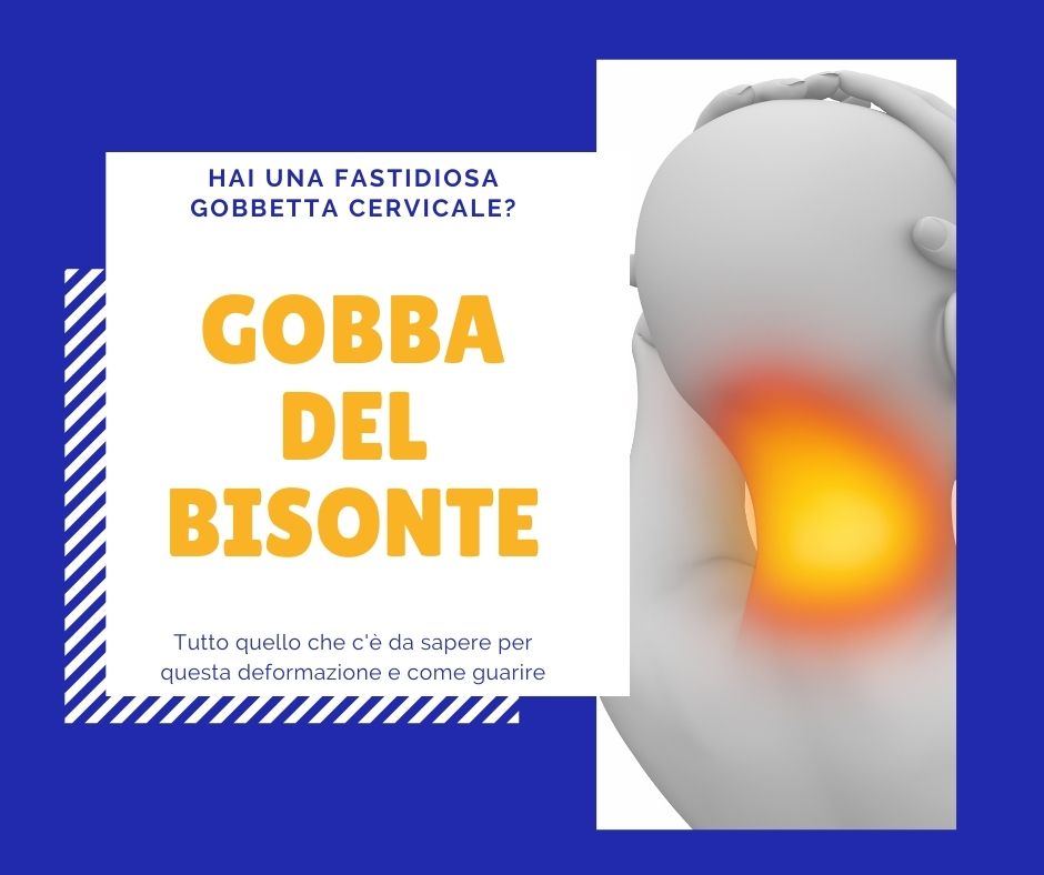 Gobba di bisonte