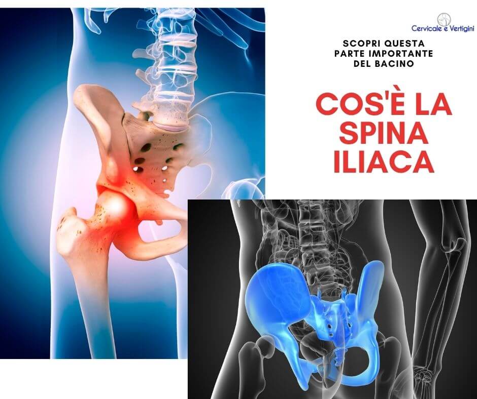 cos'è la spina iliaca