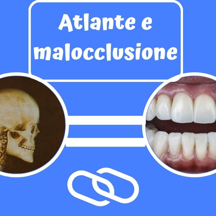 Atlante e malocclusione