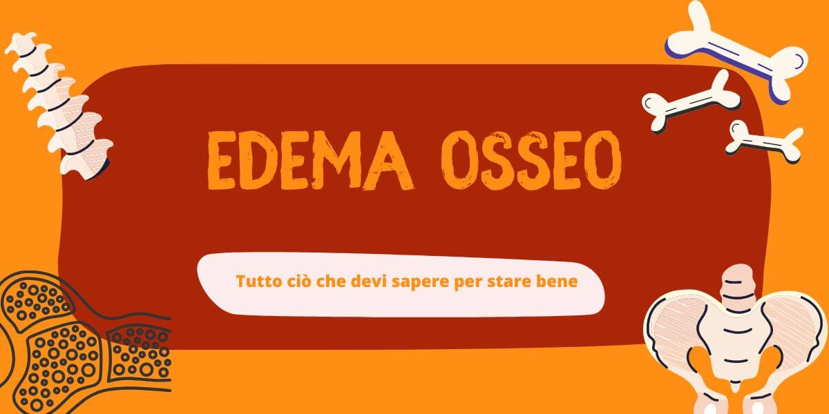 Edema osseo copertina