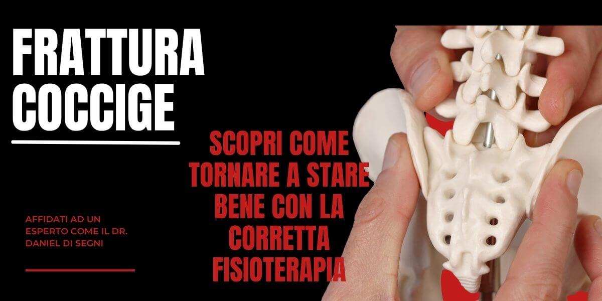 Frattura coccige