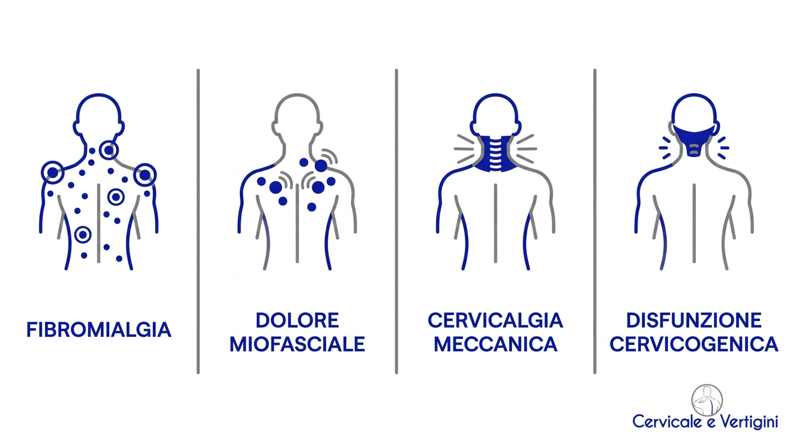 differenza fibromialgia cervicalgio cervicalgia meccanica e dolore miofasciale
